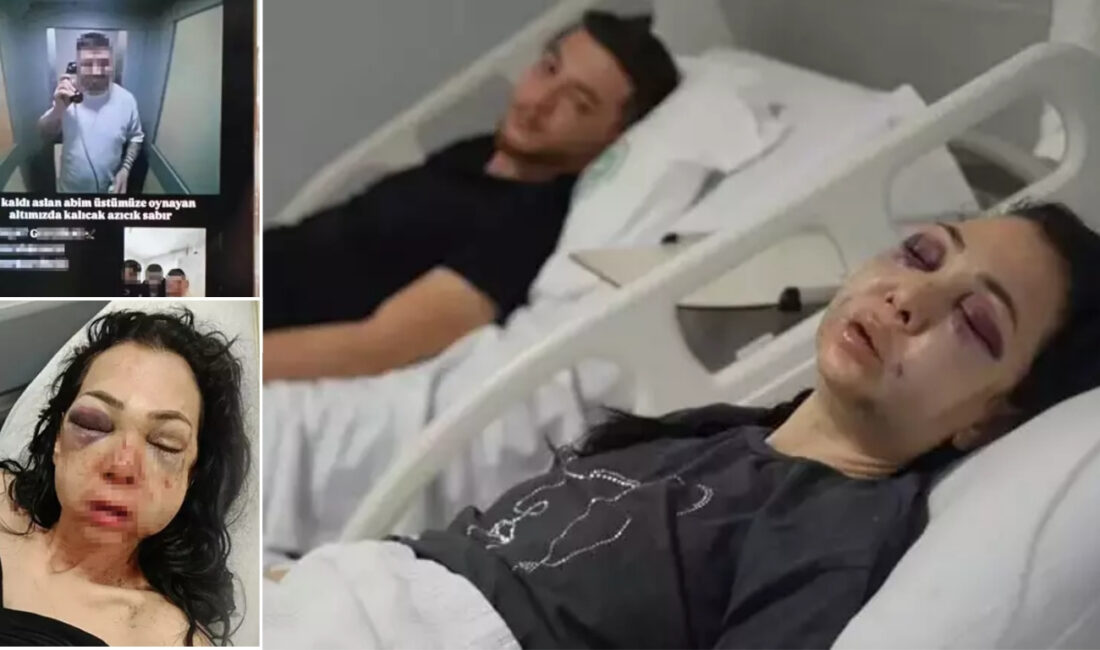 Bayram günü eğlence için gittiği mekânda saldırıya uğrayan Meryem Yıldırım,