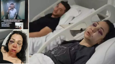 Bayram günü eğlence için gittiği mekânda saldırıya uğrayan Meryem Yıldırım,