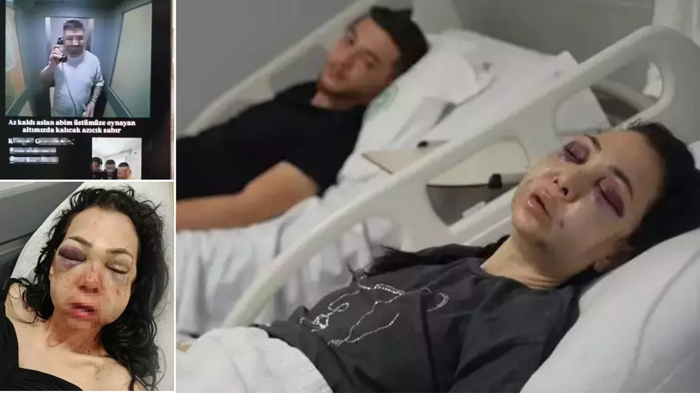 Bayram günü eğlence için gittiği mekânda saldırıya uğrayan Meryem Yıldırım,