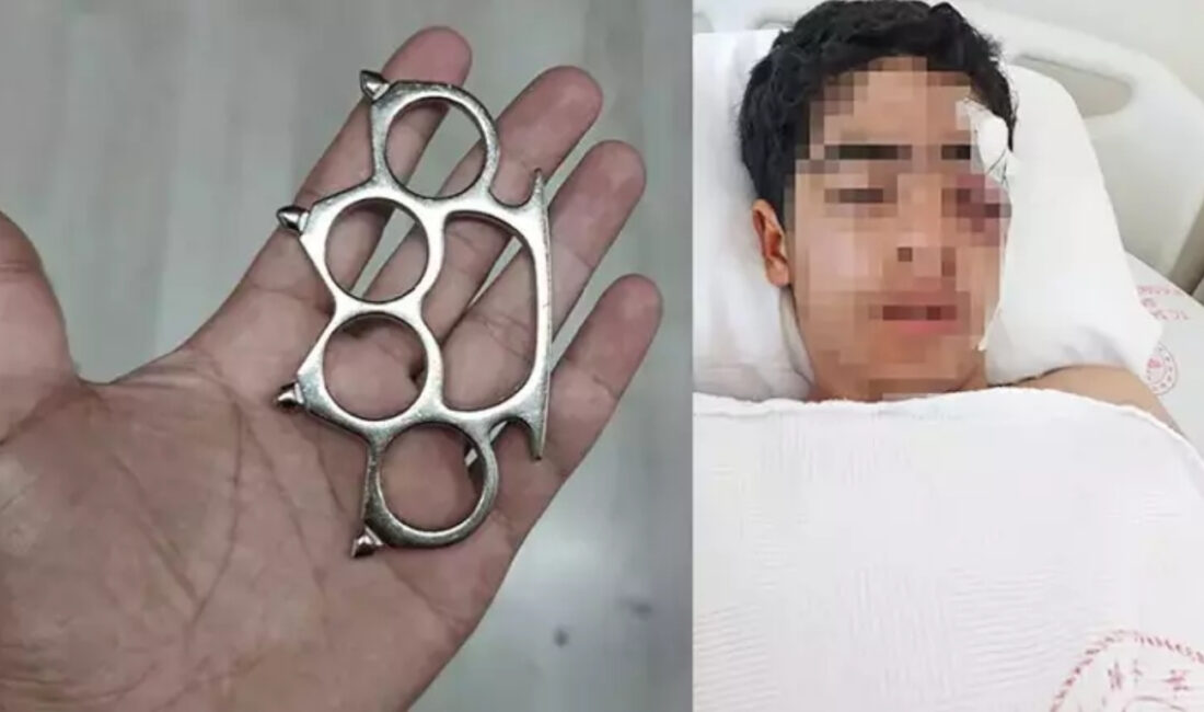 İstanbul Esenyurt’ta yaşanan akran zorbalığı olayı kan dondurdu. 15 yaşındaki