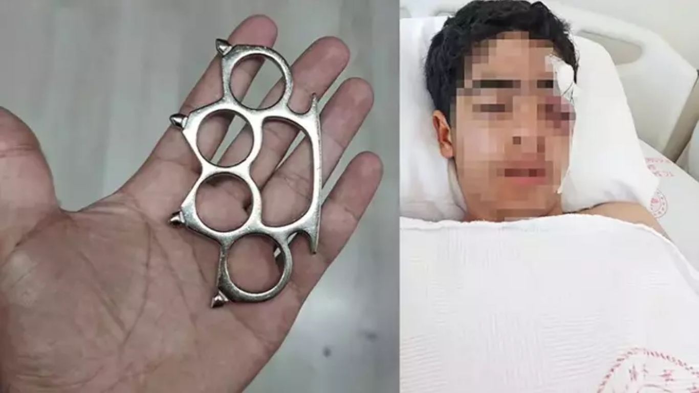İstanbul Esenyurt’ta yaşanan akran zorbalığı olayı kan dondurdu. 15 yaşındaki