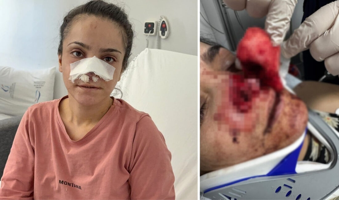 Manisa'nın Turgutlu ilçesinde yaşanan aile içi şiddet olayı Türkiye'yi sarstı.